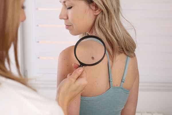 What Are Traditional Skin Lesion Removal Methods Livingston?