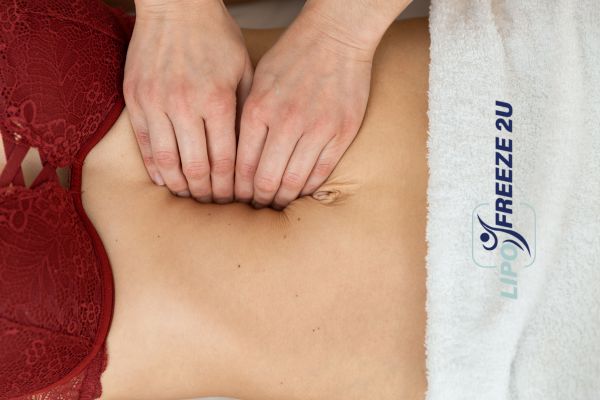 diastasis recti treatment Livingston