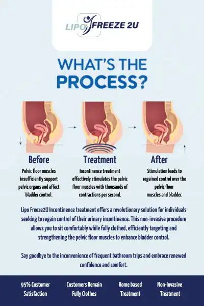 Diagram of how incontinence treatment Livingston works.