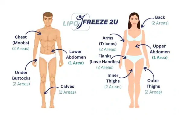 Areas you can have fat freezing treatment Livingston