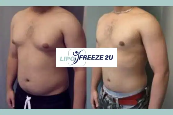 How Long Does It Take to See Results Livingston?